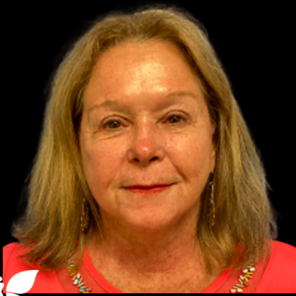 Facelift Before & After Patient #5466