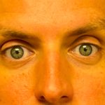 Blepharoplasty Before & After Patient #6742