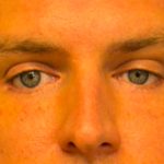 Blepharoplasty Before & After Patient #6742
