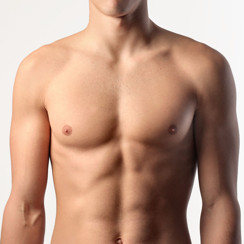 Gynecomastia